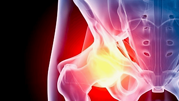 ������� ����� �����